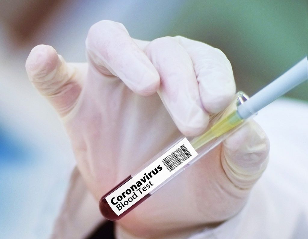 اختبار لقاحين جديدين لفيروس كورونا من جانب الخبراء فى كندا
