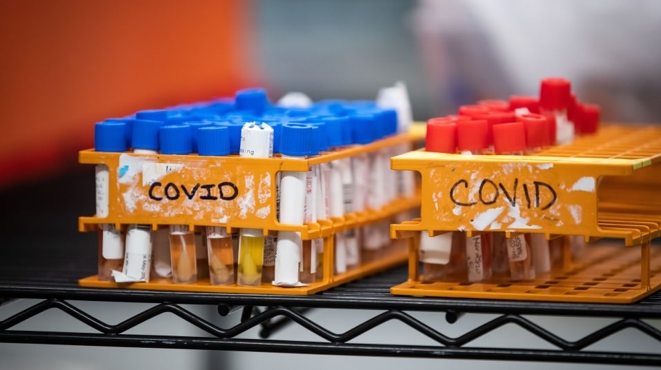 بدء المشروع الجينى فى كندا لتتبع إنتشار فيروس كوفيد 19